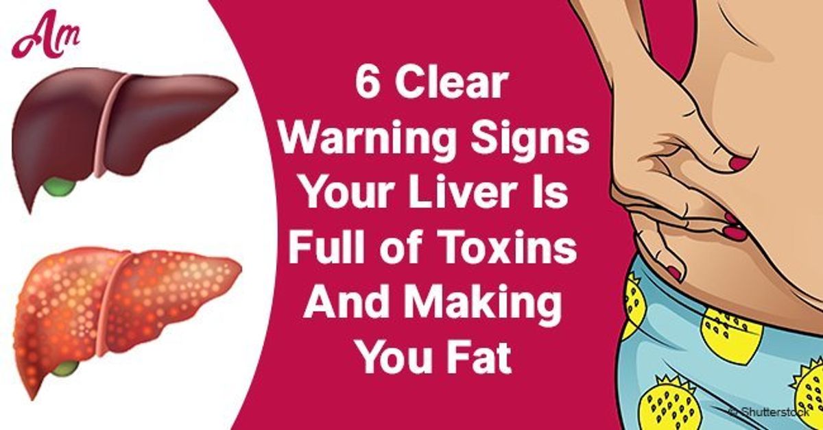 Note! Warning Signs Your Liver Is Full Of Toxins