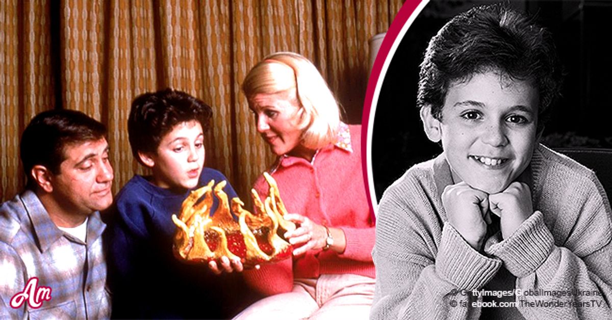 'the Wonder Years:' Cast Of This Legendary Series Then And Now