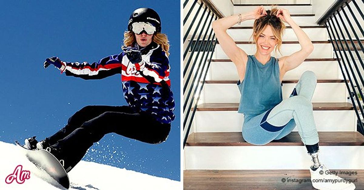 Paralympian Amy Purdy Opens up about Her Life 20 Years after She Lost ...