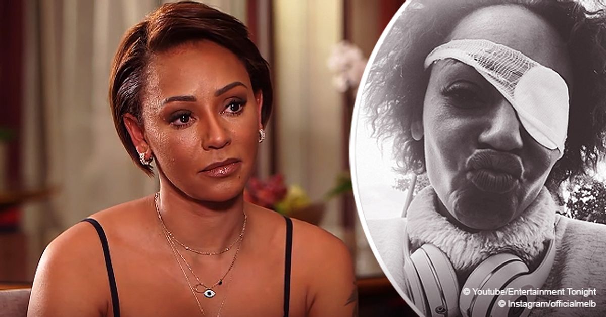 Mel B Reveals What Really Happened When She 'Went Blind' in Her Right