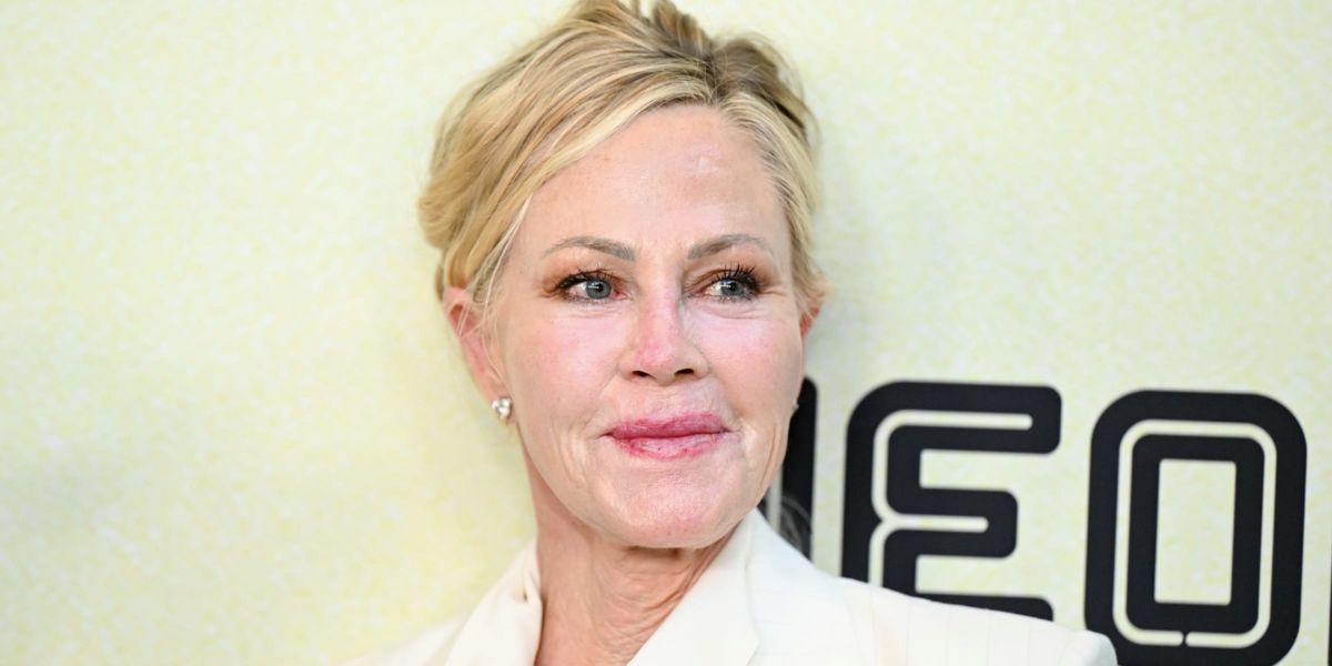 Melanie Griffith, 68, Steps Out in LA to Walk Her Dog and Fans Can't Stop Talking About Her Legs – Photo