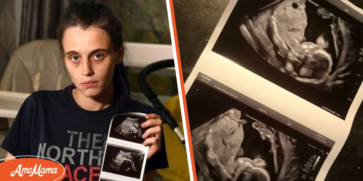 Pregnant Woman Was Told Baby Died in the Womb Next Day Her Intuition