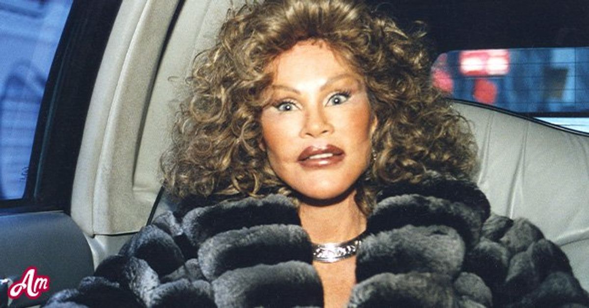 ‘Catwoman’ Jocelyn Wildenstein Denies Cosmetic Surgery Interventions In ...