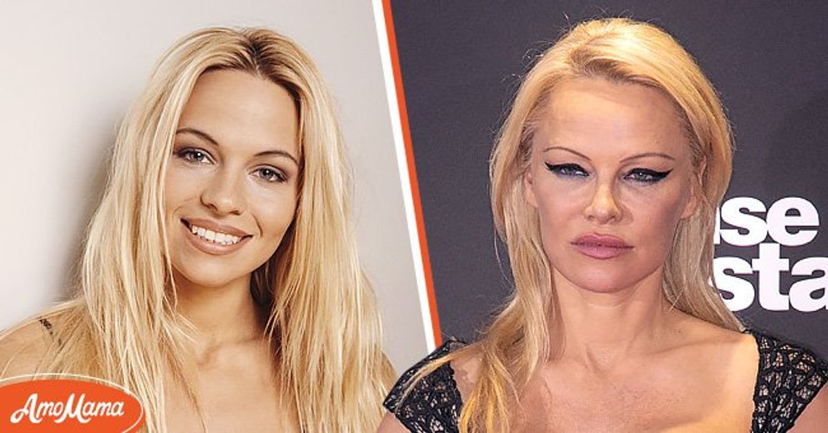 Pamela Anderson Was Told She Would Not Survive After Getting Hepatitis C from Husband: 'It All