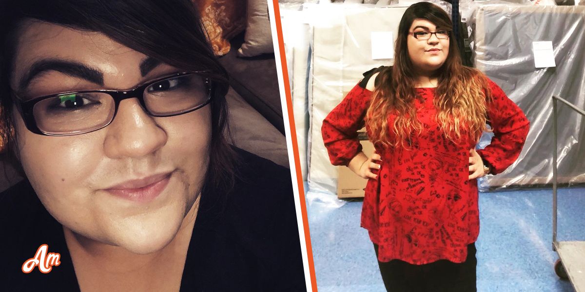 Woman, 30, Stopped Shaving Her Beard Daily & Now People Are Confused If