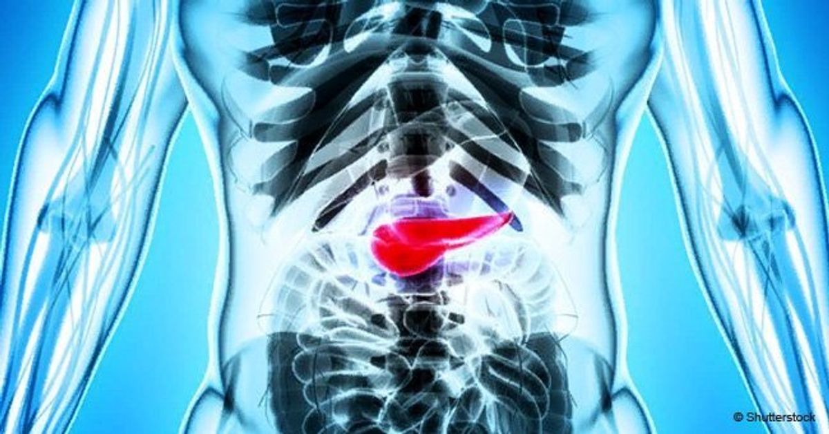6 Warning Signs And Symptoms Of Pancreatic Cancer Everyone Should Know About 3791