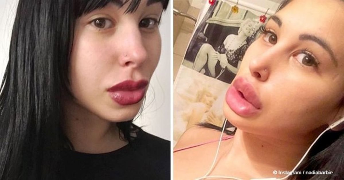 Woman's massive 34JJ breasts make it impossible for her to sleep on her