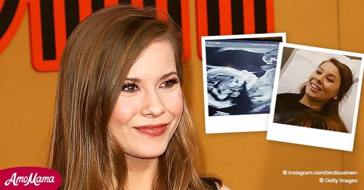 See What Bindi Irwin's Fans Spot on Her Baby's Head after She Shares