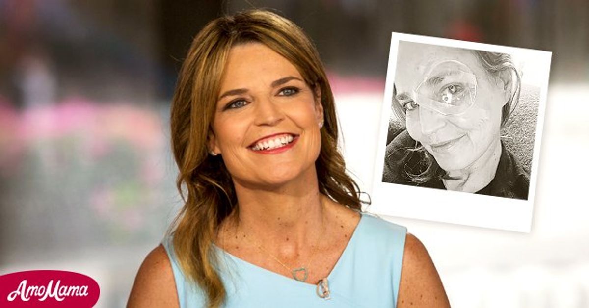 'Today' Cohost Savannah Guthrie Undergoes Surgery on Her Eye — See Her