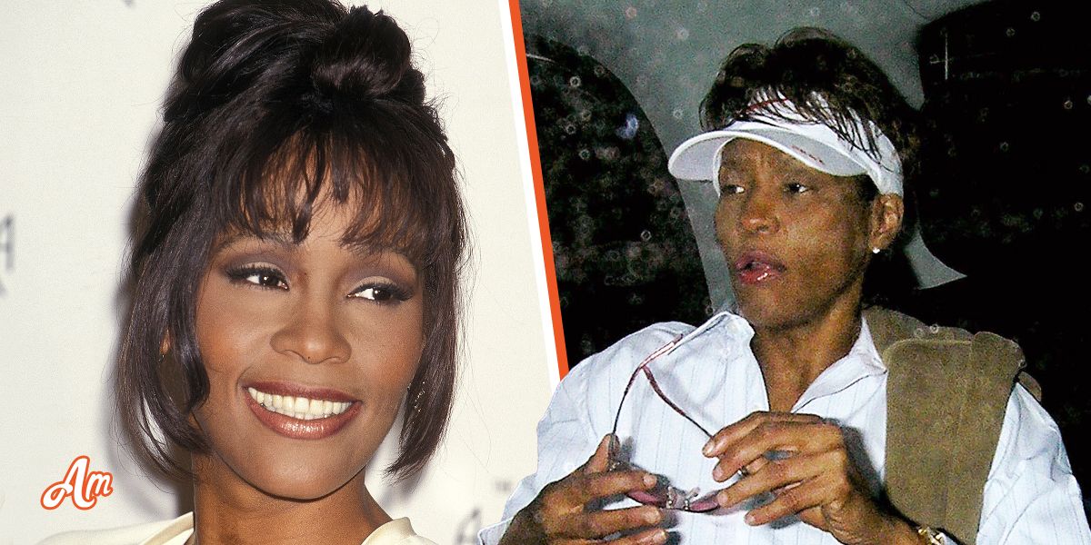 11 Missing Teeth, Sewn-on Wig and Scars: Whitney Houston's Autopsy Disclosed Grim Details of Her