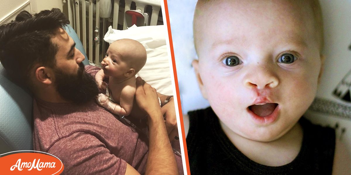 Dad of Baby with Cleft Lip Hears Friend Say Such Children Should Be ...