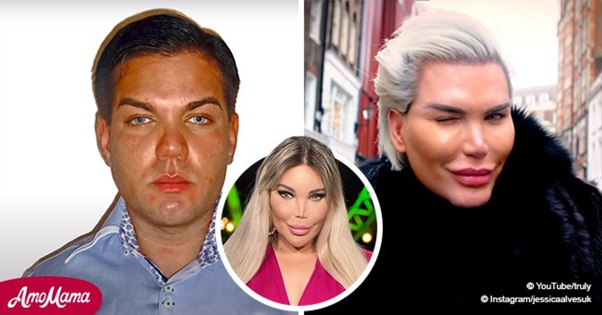 Rodrigo Alves Was the Human Ken Doll and Came Out as Transgender ...