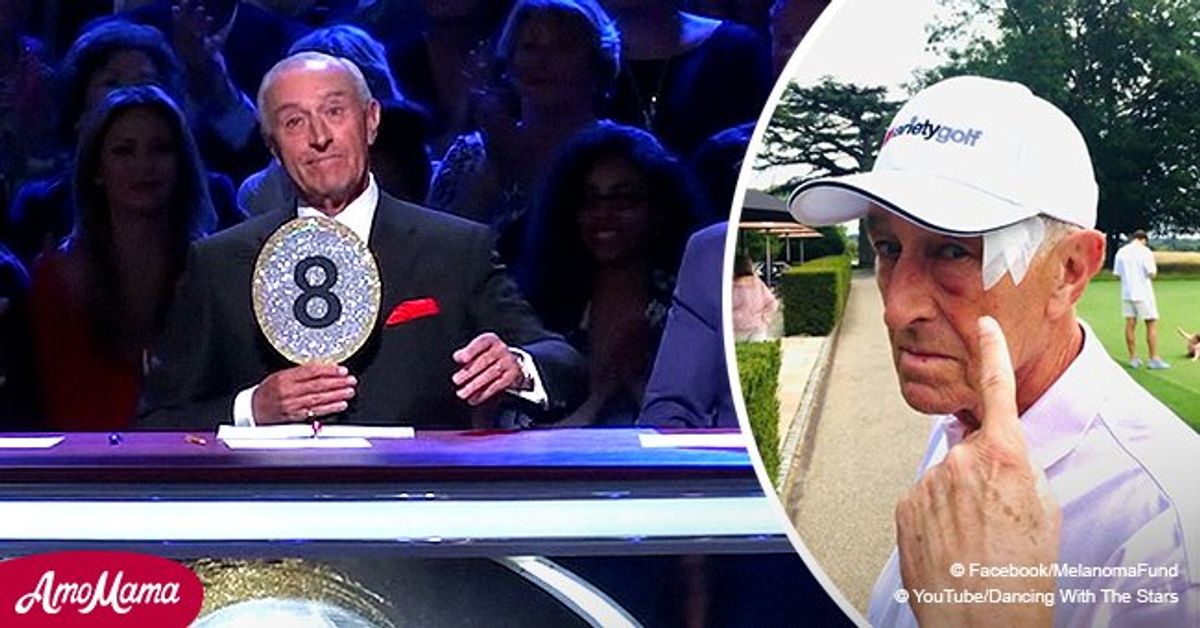 DWTS Judge Len Goodman Had Skin Cancer Removed inside His Health