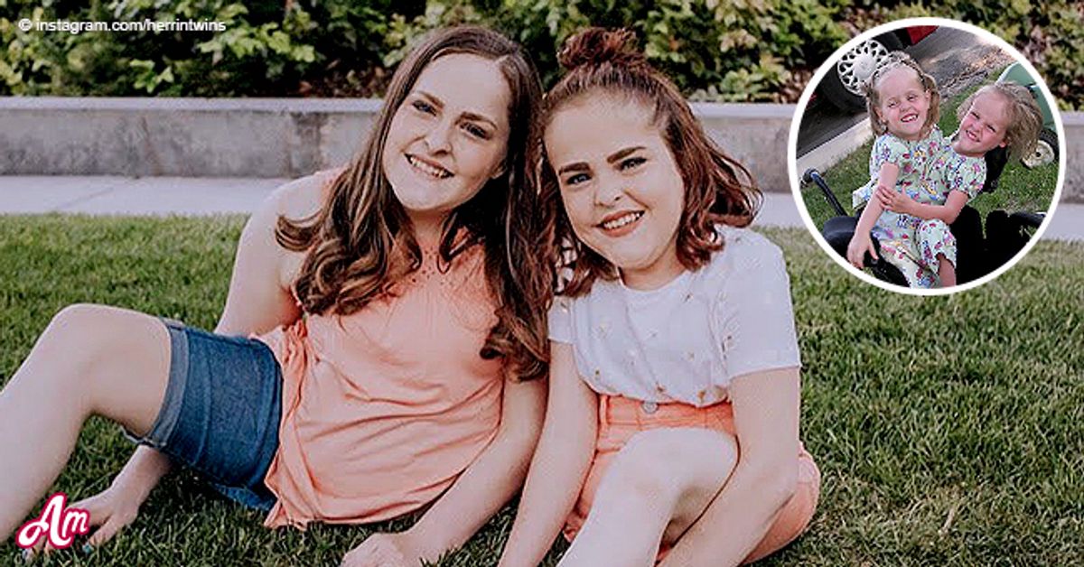Former Conjoined Twins Kendra and Maliyah Herrin Are Now Seventeen