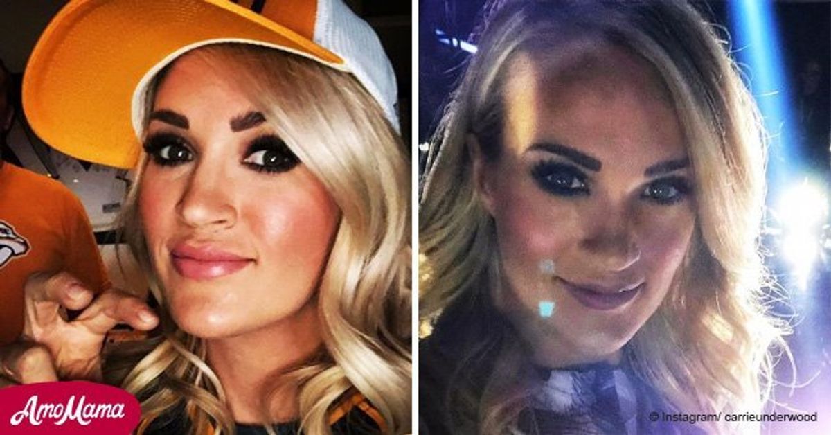 Carrie Underwood Reveals The Facial Scars Above Her Lip In A New Photo 8231