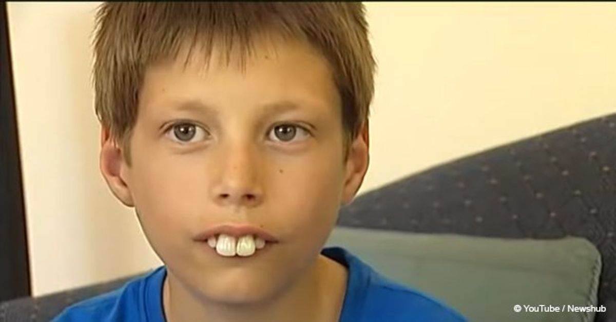 Boy bullied by classmates because of his front teeth finally gets new smile