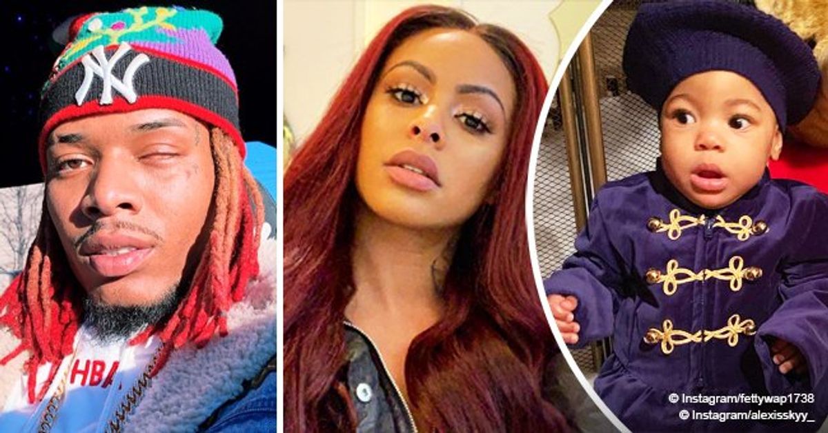 Fetty Wap and Alexis Skyy's 1yearold daughter undergoes emergency surgery(00)
