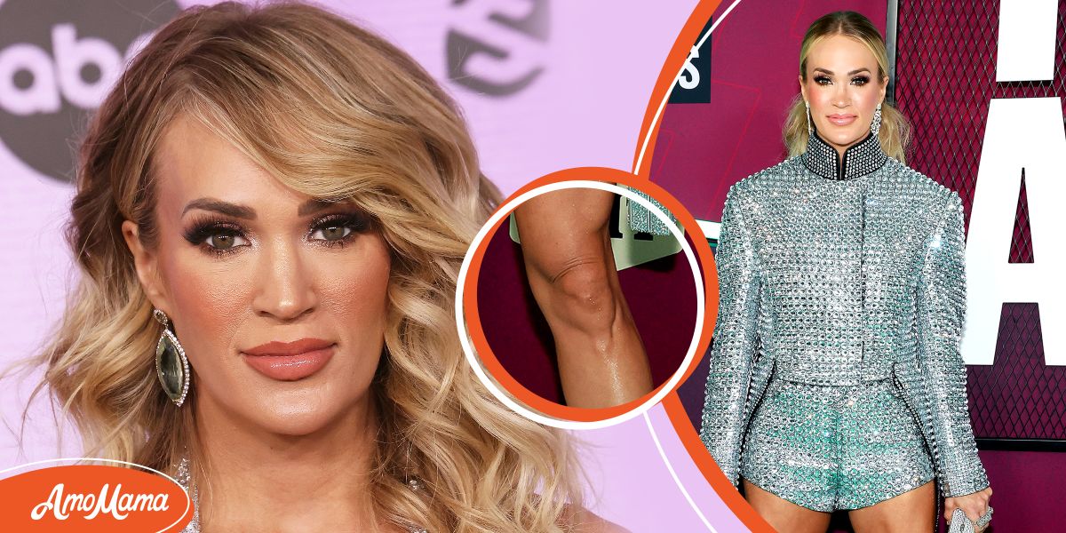 Carrie Underwood Praised for Her ‘Luscious’ Legs in New Pic after